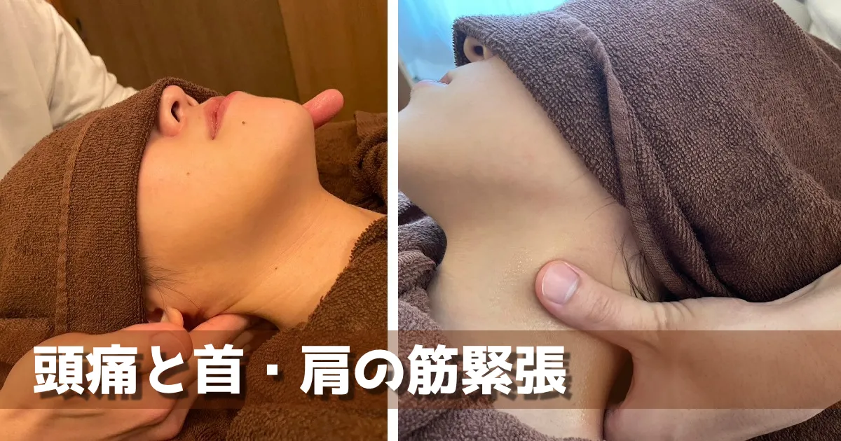 慢性的な頭痛は首・肩の筋緊張が原因?後頭下筋群と血流改善の重要性